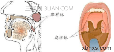 扁桃体发炎什么时候会好